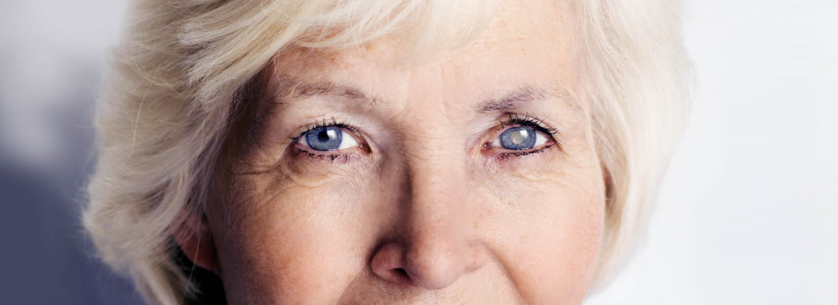 Cataract Surgery in Sharpstown