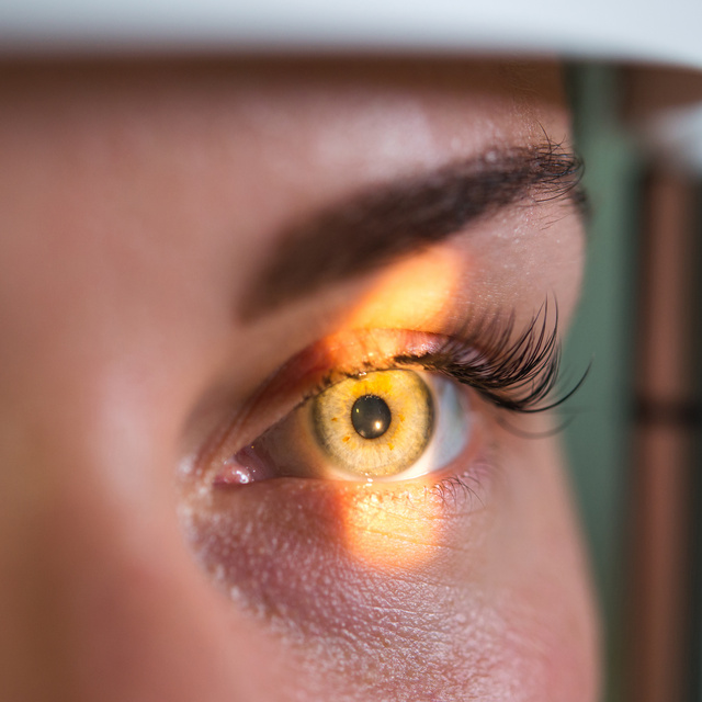 Vision Therapy in Sharpstown